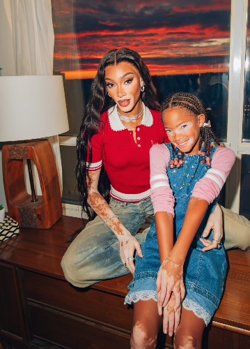 Winnie Harlow Partners With Incyte To Support People With Vitiligo